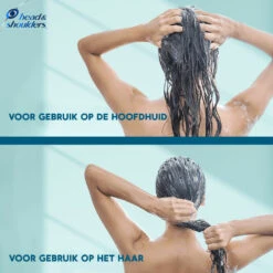6x Head & Shoulders Conditioner DERMAxPRO -Voedingssupplementen Winkel 1068946 6